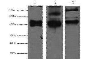 Western Blot analysis of 1) Hela, 2) MCF7, 3) 293T cells using CK-17 Monoclonal Antibody at dilution of 1:2000. (KRT17 抗体)