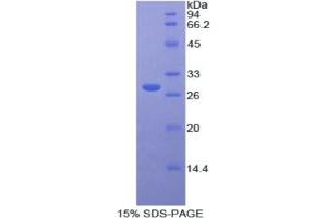 SDS-PAGE analysis of Human Protease, Serine 8 Protein. (Protease 蛋白)