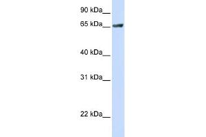 WB Suggested Anti-RUFY1 Antibody Titration:  0. (RUFY1 抗体  (C-Term))