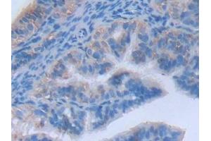 Detection of MYLK2 in Mouse Oviduct Tissue using Polyclonal Antibody to Myosin Light Chain Kinase 2 (MYLK2)