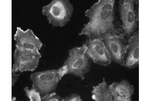 Immunofluorescent staining of A549 (ATCC CCL-185) cells. (PIK3C2B 抗体  (AA 16-209))