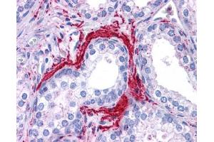 ATG5 antibody was used for immunohistochemistry at a concentration of 4-8 ug/ml. (ATG5 抗体)