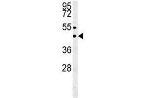 SUV39H1 western blot analysis in MDA-MB435 lysate. (SUV39H1 抗体  (N-Term))