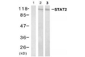 Western blot analysis of extracts from Hela cell and HL60 cell using stat2 (Ab-690) Antibody (E021536, Lane 1, 2 and 3 ) (STAT2 抗体)