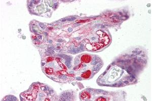 Immunohistochemistry with Placenta tissue at an antibody concentration of 5µg/ml using anti-SLC26A4 antibody (ARP41739_P050) (SLC26A4 抗体  (Middle Region))