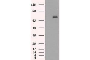 HEK293T cells were transfected with the pCMV6-ENTRY control (Left lane) or pCMV6-ENTRY BTK (Right lane) cDNA for 48 hrs and lysed. (BTK 抗体)