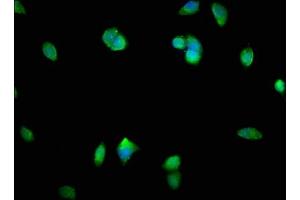 Immunofluorescence staining of MCF-7 cells with ABIN7160220 at 1:400, counter-stained with DAPI. (SMAD1 抗体  (AA 150-250))