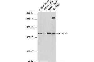 Western blot analysis of extracts of various cell lines using ATP2B2 Polyclonal Antibody at dilution of 1:1000. (ATP2B2 抗体)