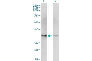 Western Blot analysis of CDK4 expression in transfected 293T cell line by CDK4 monoclonal antibody (M10), clone 1E1. (CDK4 抗体  (AA 1-303))