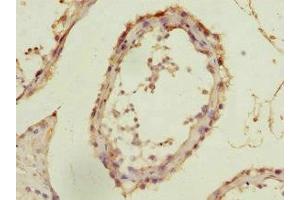 Immunohistochemistry of paraffin-embedded human testis tissue using ABIN7143006 at dilution of 1:100 (FIBP 抗体  (AA 1-364))