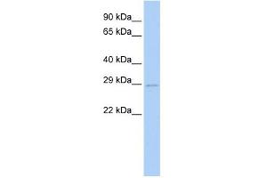 WB Suggested Anti-UBE2S Antibody Titration:  0. (UBE2S 抗体  (N-Term))
