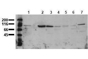 Western Blotting (WB) image for anti-Catenin (Cadherin-Associated Protein), beta 1, 88kDa (CTNNB1) (AA 35-50) antibody (ABIN126744) (CTNNB1 抗体  (AA 35-50))