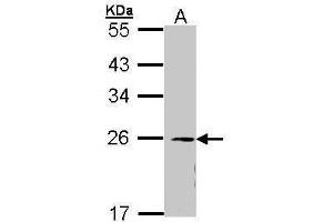 WB Image Sample (30 ug of whole cell lysate) A: 293T 12% SDS PAGE antibody diluted at 1:1000 (EIF3K 抗体)
