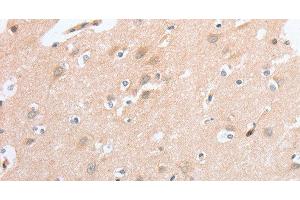 Immunohistochemistry of paraffin-embedded Human brain tissue using SIGLEC9 Polyclonal Antibody at dilution 1:40 (SIGLEC9 抗体)