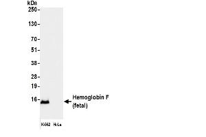anti-Fetal Hemoglobin (HbF) antibody