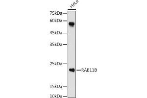 Western blot analysis of extracts of HeLa cells, using RB antibody (ABIN7269795) at 1:1000 dilution. (RAB11B 抗体  (AA 130-215))