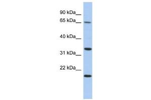 FAM79B antibody used at 1 ug/ml to detect target protein. (TPRG1 抗体  (N-Term))