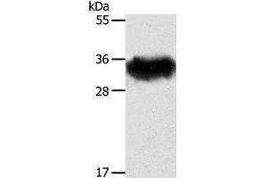 Western Blot analysis of Mouse brain tissue using STX1A Polyclonal Antibody at dilution of 1:600 (STX1A 抗体)
