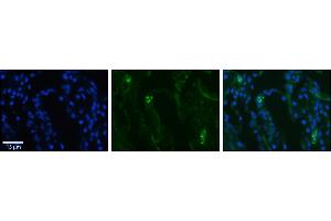 Rabbit Anti-SLCO2B1 Antibody     Formalin Fixed Paraffin Embedded Tissue: Human Lung Tissue  Observed Staining: Membrane in alveolar type I cells  Primary Antibody Concentration: 1:100  Other Working Concentrations: 1/600  Secondary Antibody: Donkey anti-Rabbit-Cy3  Secondary Antibody Concentration: 1:200  Magnification: 20X  Exposure Time: 0. (SLCO2B1 抗体  (N-Term))