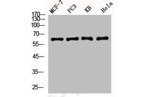 Western Blot analysis of MCF7 PC-3 KB HELA cells using Phospho-YAP (S127) Polyclonal Antibody (YAP1 抗体  (pSer127))