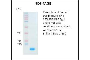 SDS-PAGE (SDS) image for Epidermal Growth Factor (EGF) (Active) protein (ABIN5509294) (EGF 蛋白)