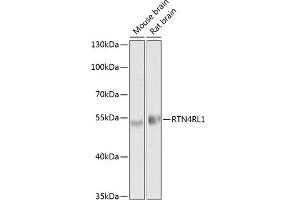 Western blot analysis of extracts of various cell lines, using RTN4RL1 antibody (ABIN6130678, ABIN6147298, ABIN6147299 and ABIN6214124) at 1:1000 dilution.