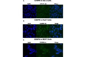 Immunofluorescent staining of HeLa (A), Huh7 (B) and MCF7 (C) cells with CENPN polyclonal antibody  at 1:250 dilution. (CENPN 抗体  (Internal Region))