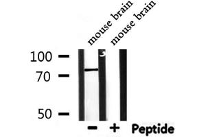 Western blot analysis of extracts from mouse brain, using CD2AP antibody.
