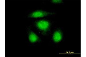 Immunofluorescence of purified MaxPab antibody to OSTF1 on HeLa cell. (OSTF1 抗体  (AA 1-217))