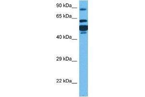Host:  Rabbit  Target Name:  CPT1A  Sample Tissue:  Human HT1080 Whole Cell  Antibody Dilution:  1ug/ml