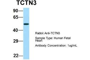 Host:  Rabbit  Target Name:  TCTN3  Sample Type:  Human Fetal Heart  Antibody Dilution:  1. (TCTN3 抗体  (Middle Region))