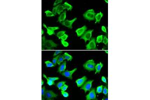 Immunofluorescence analysis of A549 cell using HSPB1 antibody.