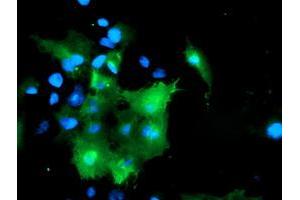 Anti-DOK7 mouse monoclonal antibody (ABIN2455816) immunofluorescent staining of COS7 cells transiently transfected by pCMV6-ENTRY DOK7 (RC219267). (DOK7 抗体)