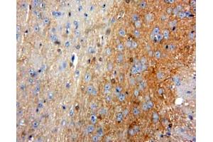 Used in DAB staining on fromalin fixed paraffin-embedded Brain tissue (ACP5 抗体  (AA 79-318))