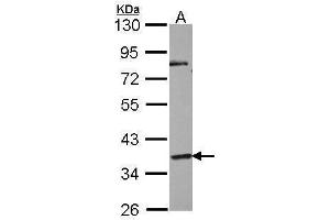 WB Image Sample (30 ug of whole cell lysate) A: NT2D1 10% SDS PAGE antibody diluted at 1:1000 (GPR45 抗体)