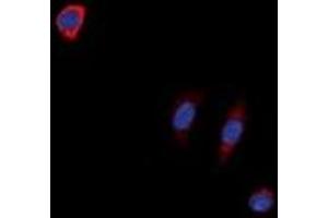 Immunofluorescent analysis of NTR1 staining in SKNSH cells. (NTSR1 抗体)
