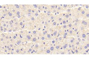 Detection of CTSD in Mouse Liver Tissue using Polyclonal Antibody to Cathepsin D (CTSD)