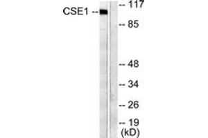 Western blot analysis of extracts from 293 cells, using CSE1L Antibody. (Exportin 2 抗体  (AA 1-50))