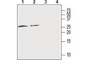 Western Blotting (WB) image for anti-Receptor (G Protein-Coupled) Activity Modifying Protein 2 (RAMP2) (AA 54-68), (Extracellular) antibody (ABIN7043596)
