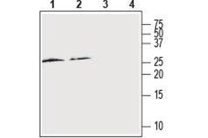 Western blot analysis of rat spleen (lanes 1 and 3) and cortex (lanes 2 and 4): - 1,2. (RAMP2 抗体  (Extracellular, N-Term))