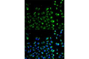 Immunofluorescence analysis of A549 cell using ATG13 antibody. (ATG13 抗体)