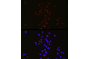 Immunofluorescence analysis of Neuro-2a cells using Parkin Rabbit pAb  at dilution of 1:50 (40x lens).