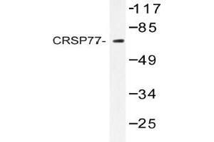 Western blot (WB) analysis of CRSP77 antibody in extracts from HT-29 cells. (MED17 抗体)