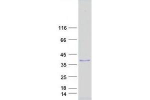 Western Blotting (WB) image for Siah E3 Ubiquitin Protein Ligase 2 (SIAH2) protein (Myc-DYKDDDDK Tag) (ABIN2732023)