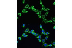 Immunofluorescence analysis of NIH/3T3 cells using VEGFA Rabbit pAb (ABIN6128907, ABIN6150083, ABIN6150084 and ABIN6215912) at dilution of 100 (40x lens). (VEGFA 抗体  (AA 27-126))