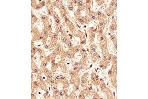 Immunohistochemical analysis of paraffin-embedded H. (FOLH1B 抗体  (AA 155-183))