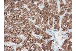 Immunohistochemical staining of paraffin-embedded Human liver tissue using anti-CYP2A6 mouse monoclonal antibody. (CYP2A6 抗体)