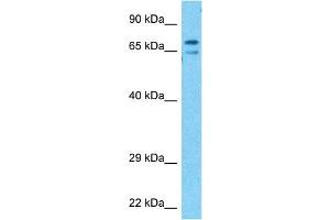Host:  Rabbit  Target Name:  KCND3  Sample Type:  Stomach Tumor lysates  Antibody Dilution:  1. (KCND3 抗体  (C-Term))