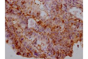 Immunohistochemistry (IHC) image for anti-Enolase 1 (ENO1) (AA 2-434) antibody (ABIN7143869)