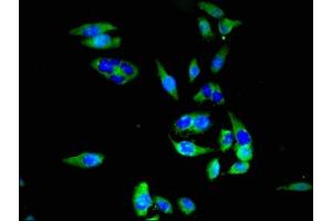 Immunofluorescence (IF) image for anti-Solute Carrier Family 2 (Facilitated Glucose Transporter), Member 1 (SLC2A1) (AA 263-458) antibody (ABIN7170002)